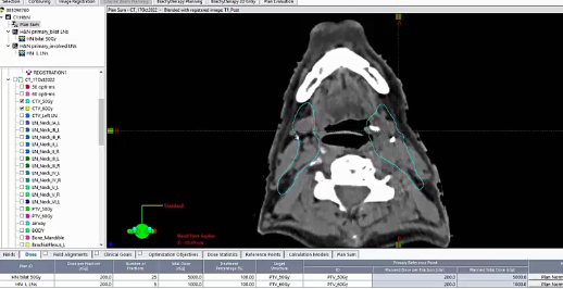 10/31/2022 - Dr. David Sher - Radiation Oncology - US Head & Neck