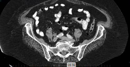 02/07/24 - Dr. Christine Fisher - Radiation Oncology - GYN