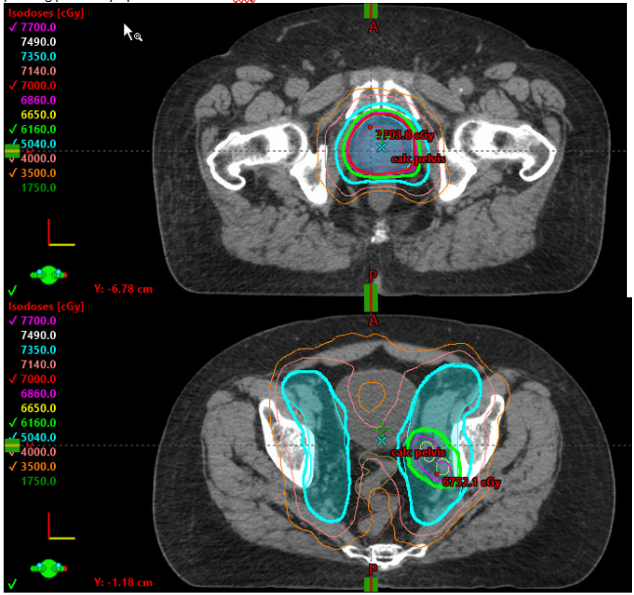 12/14/2021 - Dr. Howard Sandler - Radiation Oncology - US GU