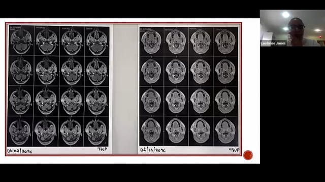 06/28/2022 - Dr. Laurianne James - Ra...