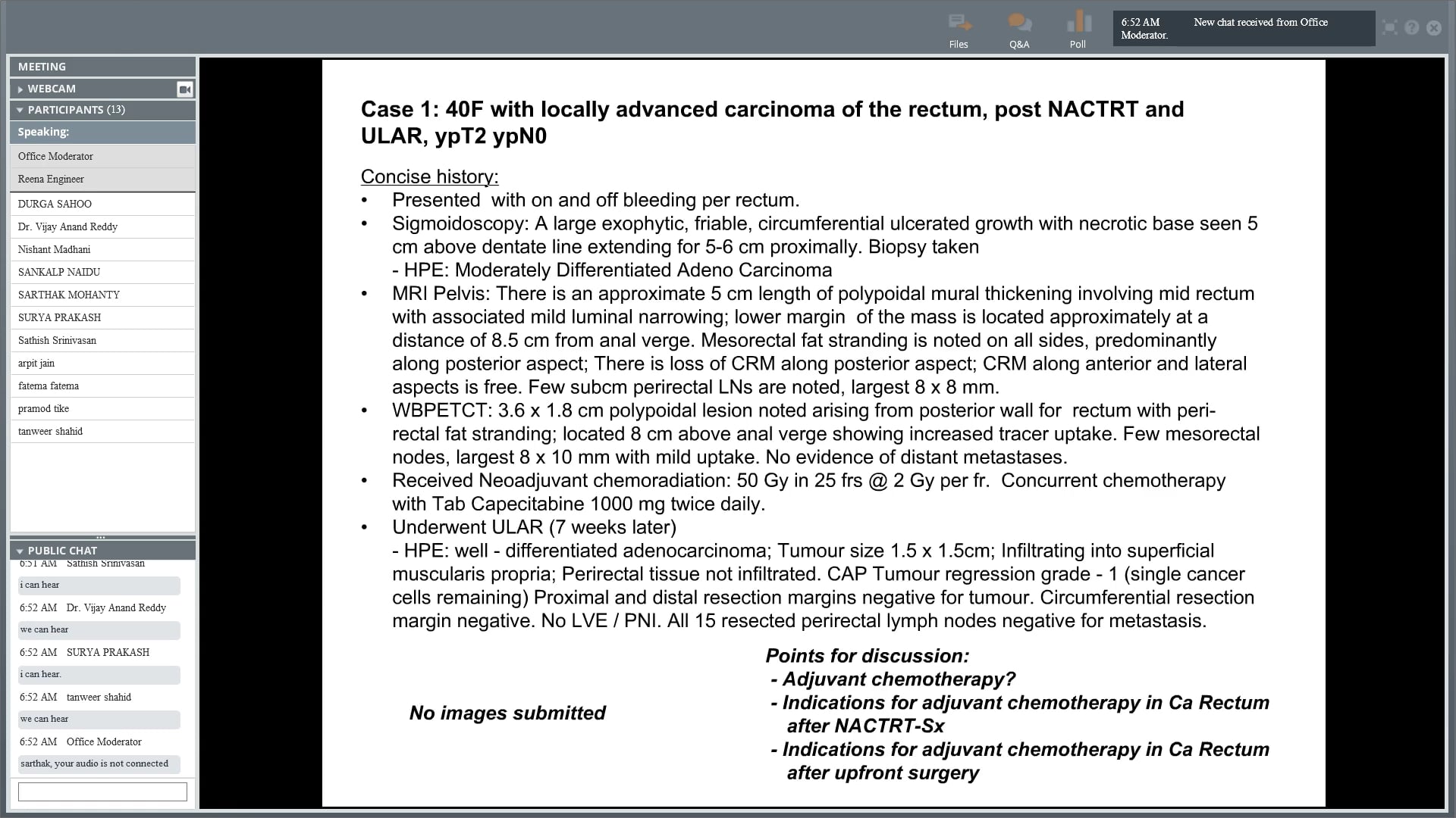 03/29/18 - Dr. Reena Engineer - Radiation Oncology - GI India