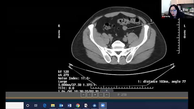 04/21/21 - Dr. Andrea Ng - Radiation ...