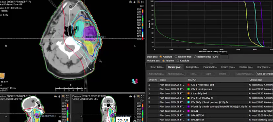 03/25/2024 - Dr. David Sher - Radiation Oncology - Head & Neck