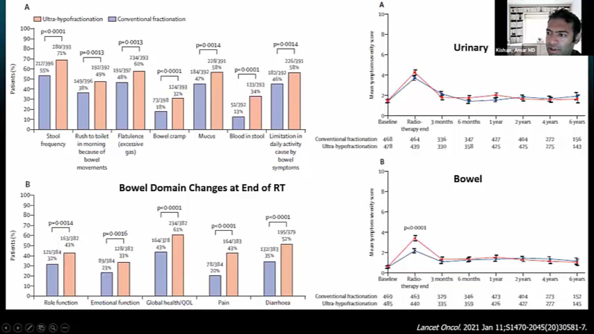 04/29/21 - Dr. Amar Kishan - Radiation Oncology - India SBRT