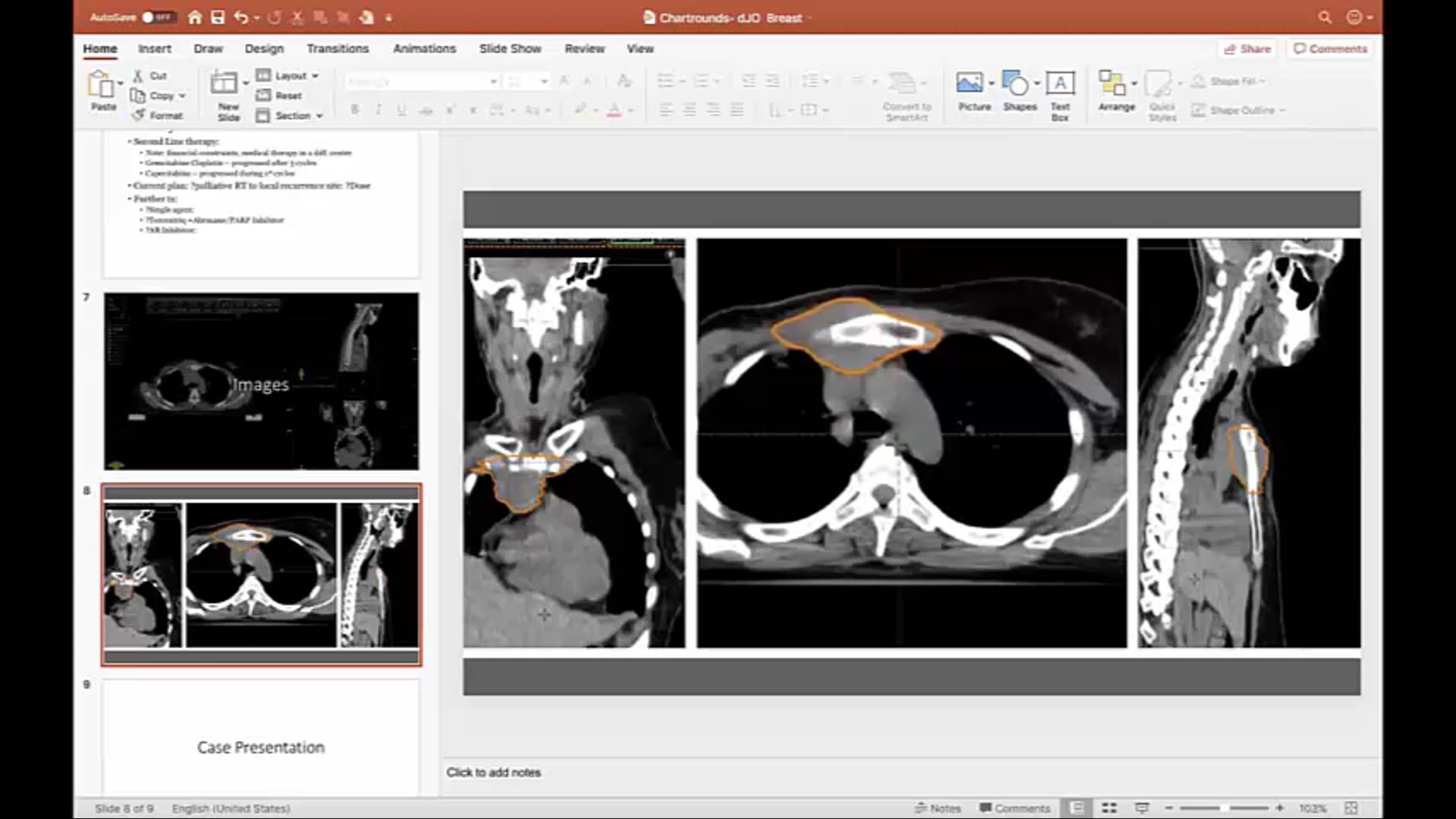 09/09/20 - Dr. Onyinye Balogun - Radiation Oncology - Breast Africa