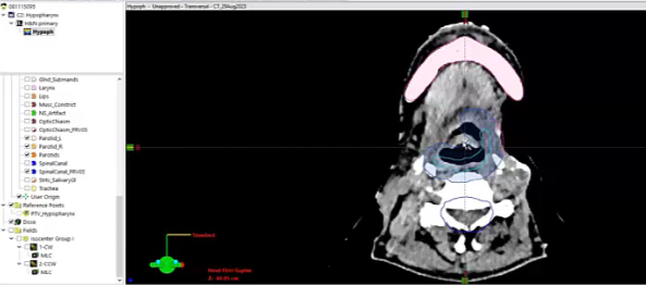 09/25/2023 - Dr. David Sher - Radiation Oncology - Head & Neck