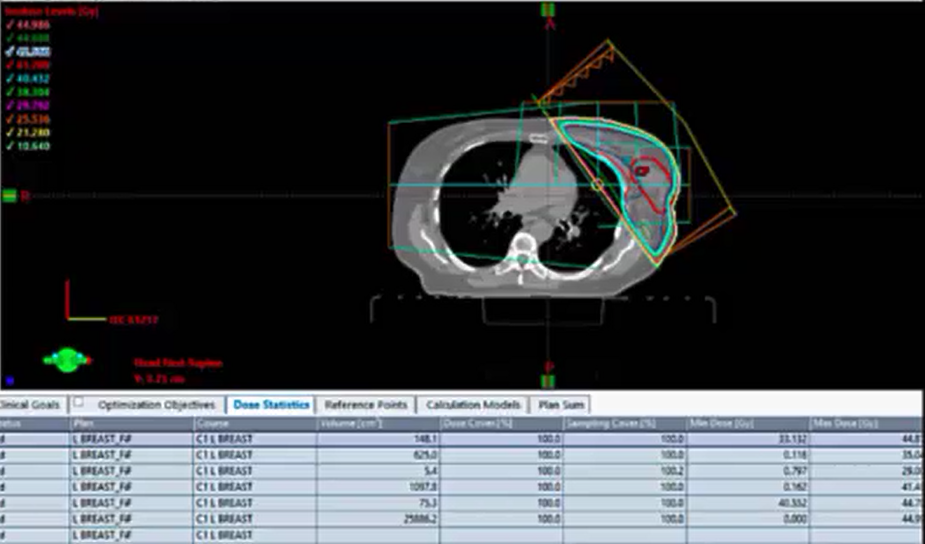 06/11/2021 - Dr. Abram Recht - Radiation Oncology - Breast