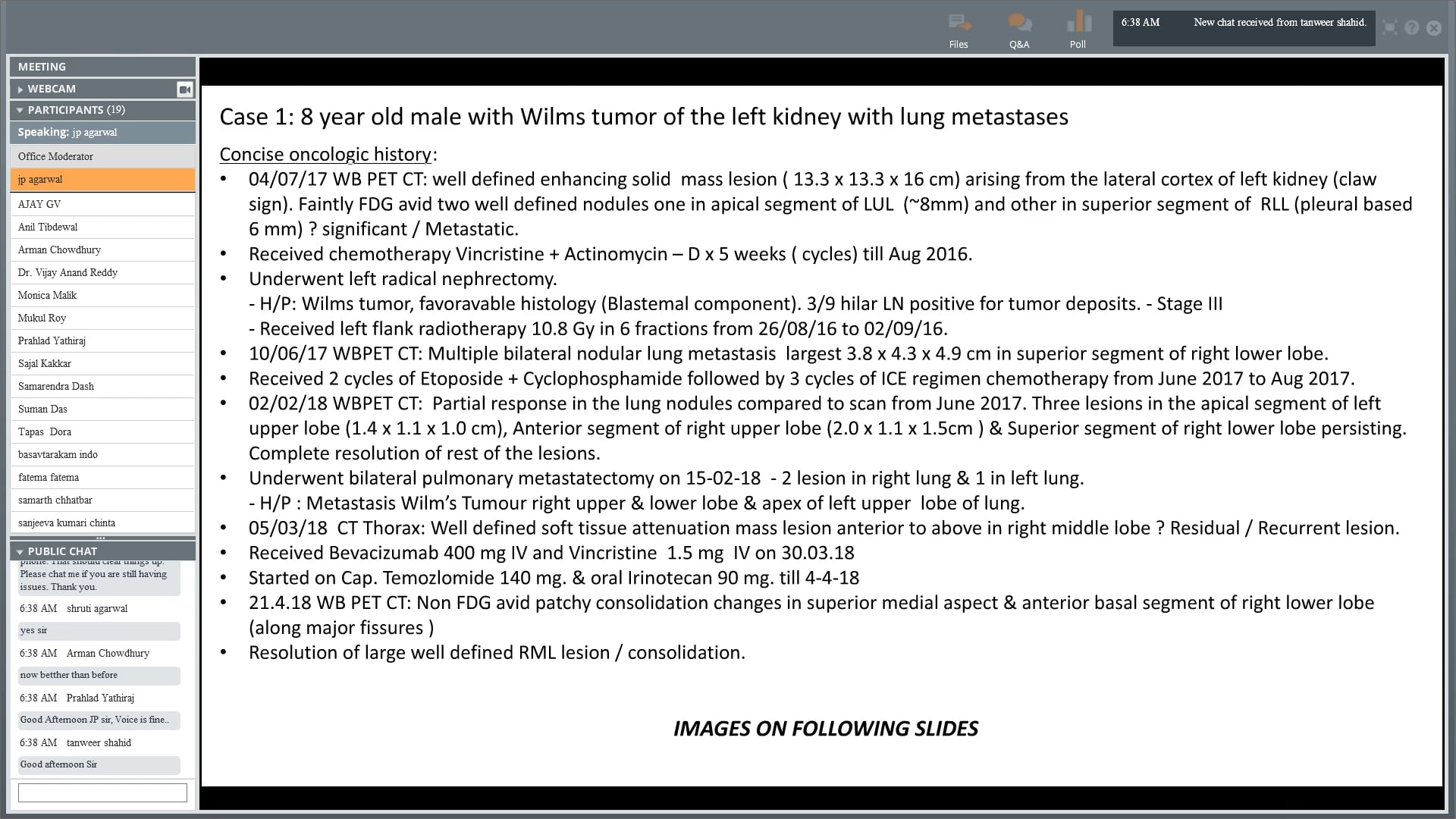 05/24/18 - Dr. J.P. Agarwal - Radiation Oncology - Lung India