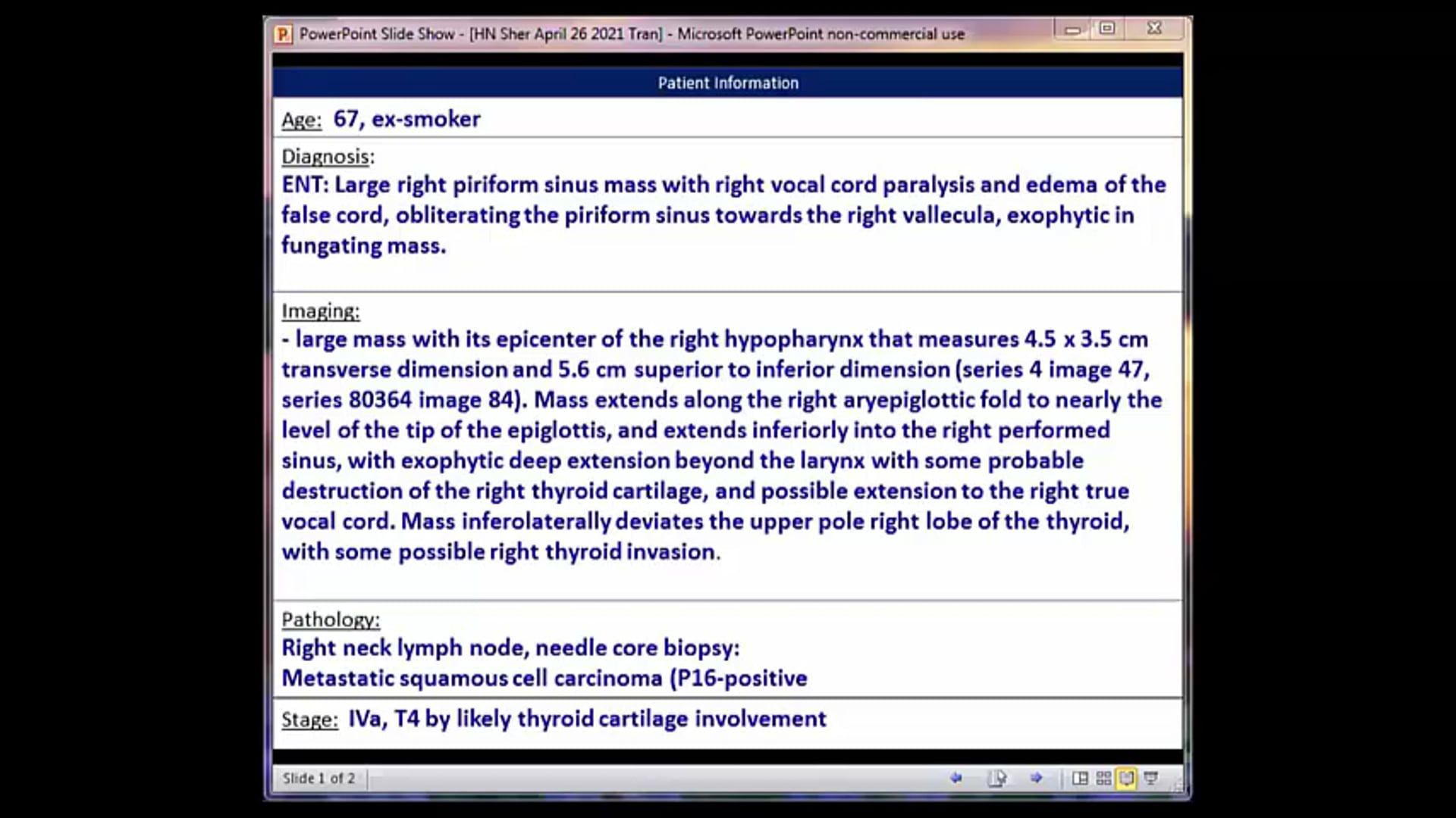 04/26/21 - Dr. David Sher - Radiation Oncology - Head and Neck