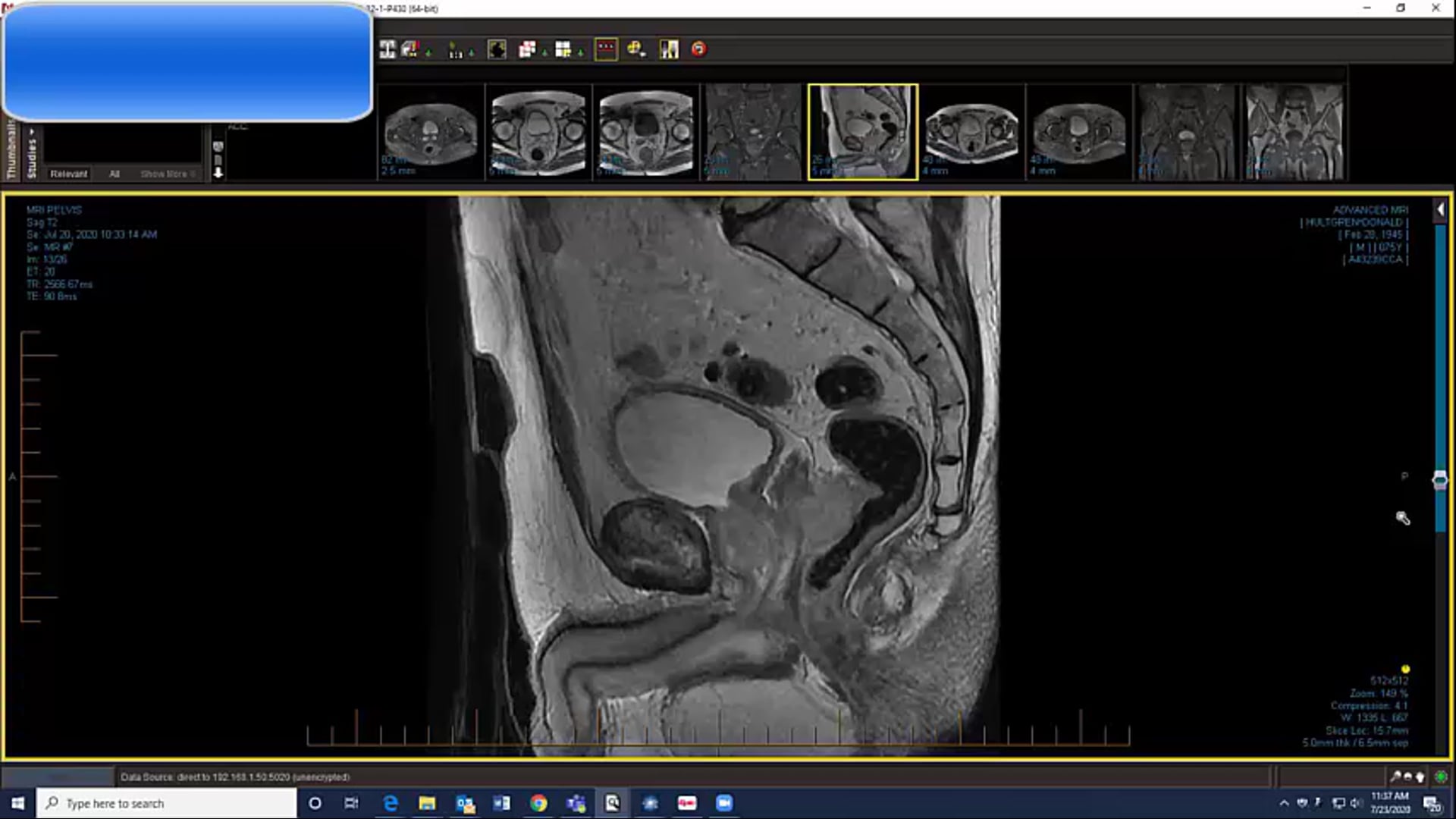 07/23/20 - Dr. Ronald Chen - Radiation Oncology - GU US