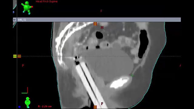 03/26/20 - Dr. Catheryn Yashar - Radi...