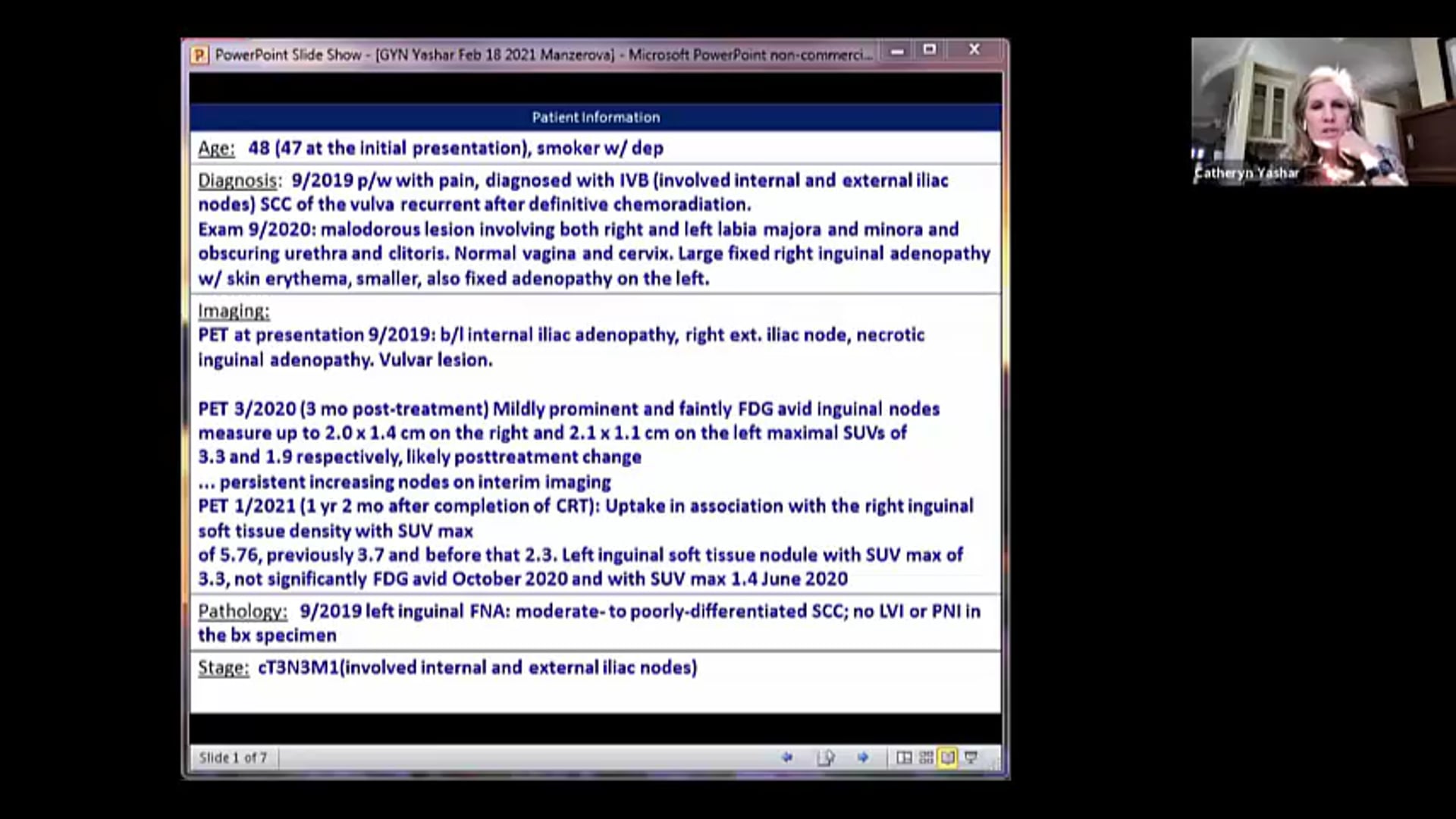 02/18/21 - Dr. Catheryn Yashar - Radiation Oncology - GYN US