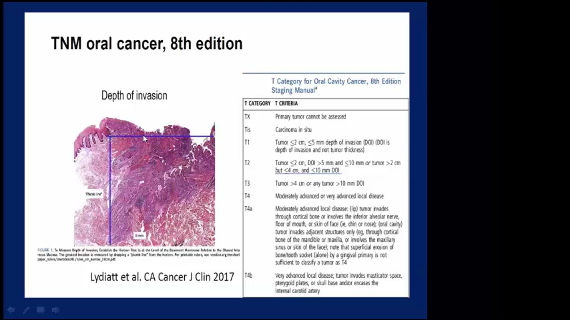 12/27/18 - Dr. Cessal Kainickal - Radiation Oncology - Head and Neck India