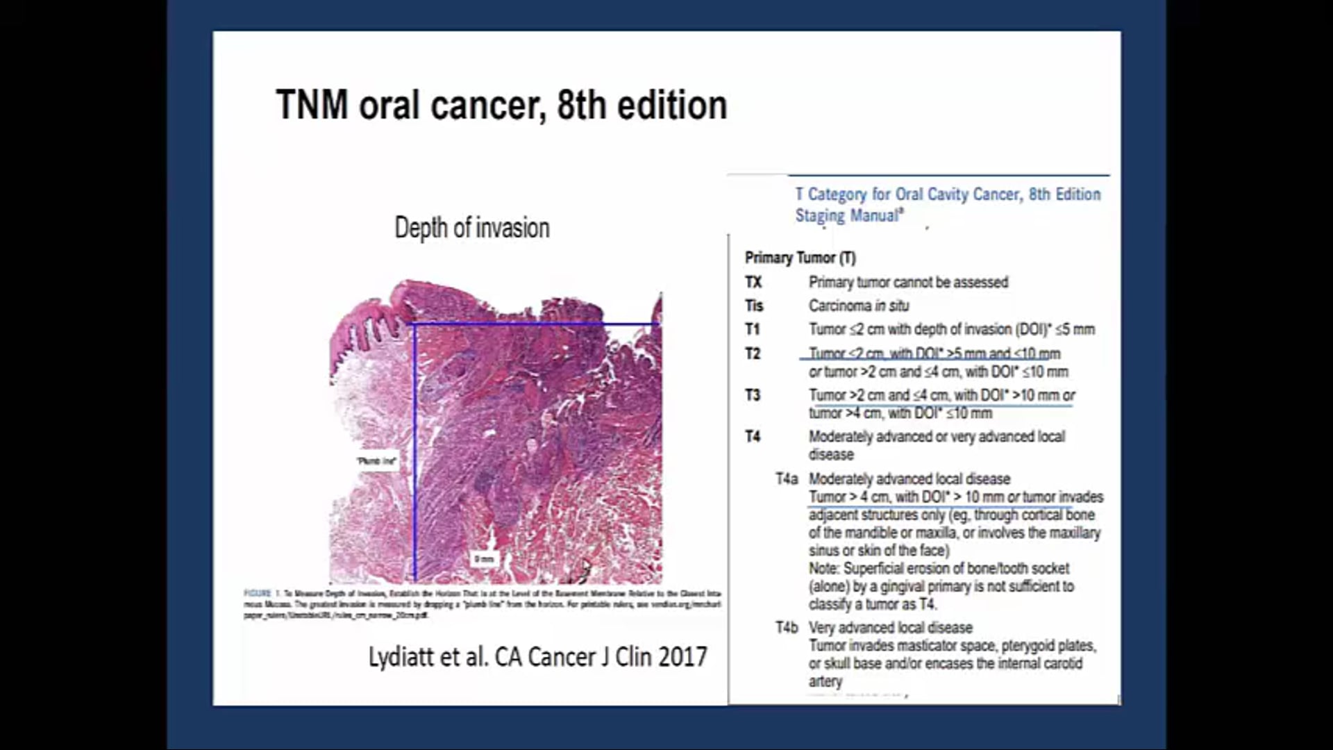 06/25/20 - Dr. Cessal Kainickal - Radiation Oncology - Head and Neck India
