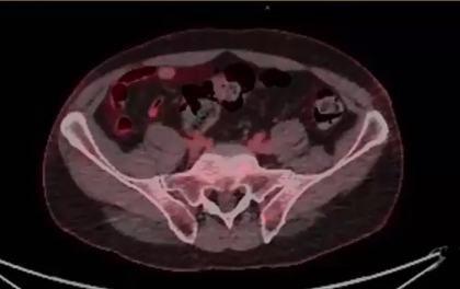 05/08/2025 - Dr. Howard Sandler - Radiation Oncology - GU