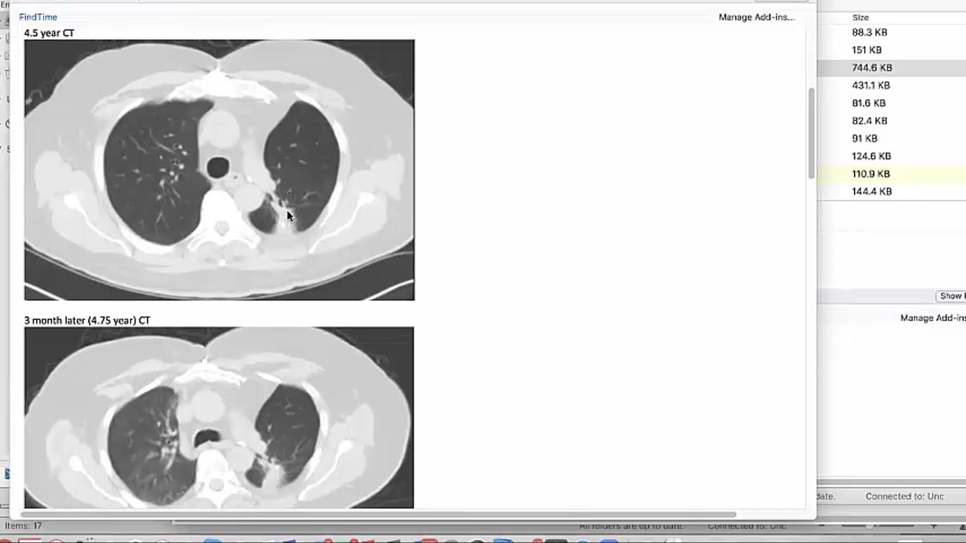 08/29/19 - Dr. Larry Marks - Radiation Oncology - Lung US
