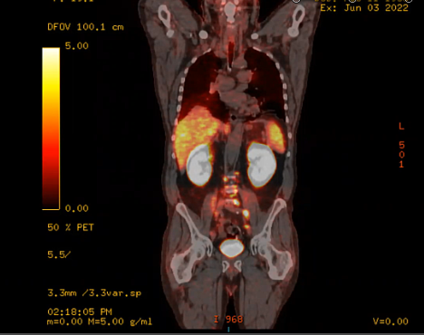 06/16/2022 - Dr. Howard Sandler - Radiation Oncolog - GU