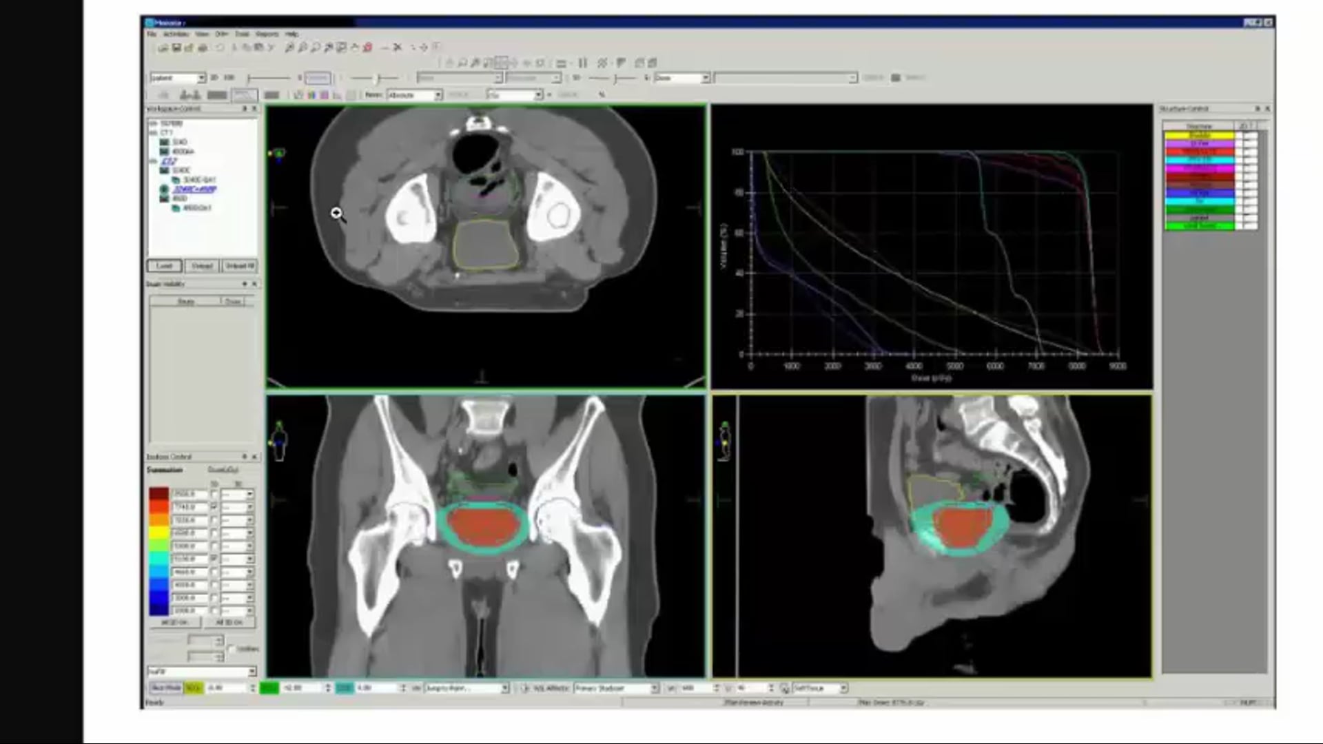 03/20/19 - Dr. Ronald Chen - Radiation Oncology - GU US