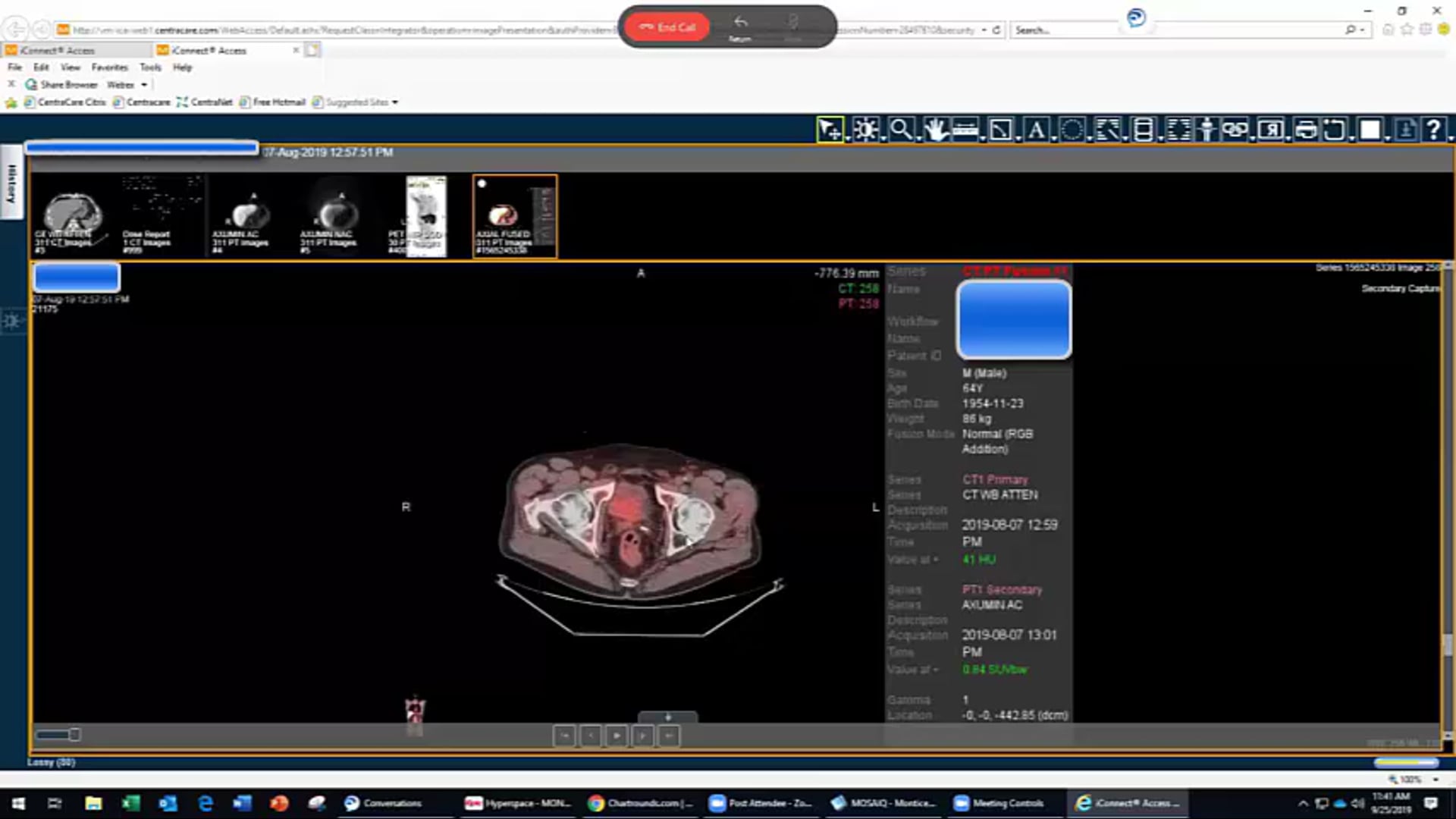 09/25/19 - Dr. Ronald Chen - Radiation Oncology - GU US