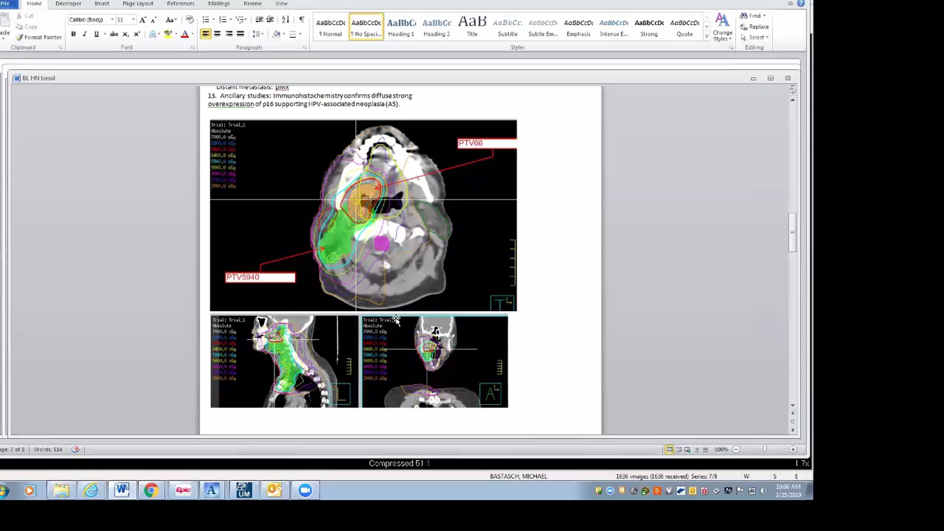 02/25/19 - Dr. David Sher - Radiation Oncology - Head and Neck US