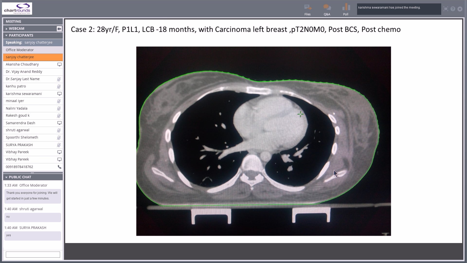 08/02/18 - Dr. Sanjoy Chatterjee - Radiation Oncology - Breast India