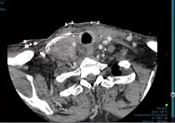 10/31/2025 - Dr. David Sher - Radiation Oncology - Head & Neck