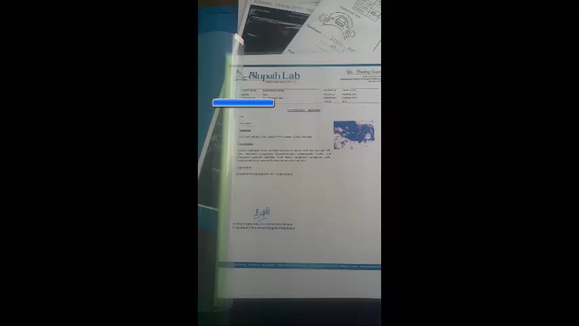 03/18/19 - Dr. Onyinye Balogun - Radiation Oncology - GI Africa