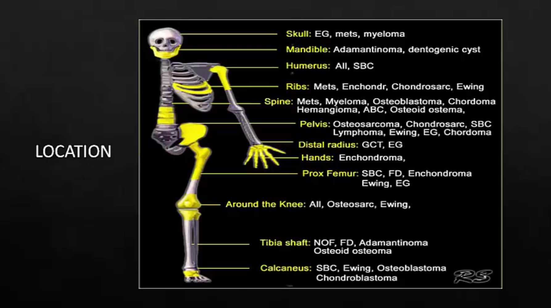 12/10/20 - Dr. Rajeev Reddy - Radiation Oncology - Sarcoma India