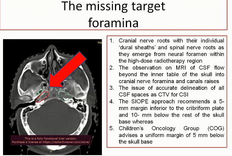 12/09/2021 - Dr. Kanhu Charan Patro - Radiation Oncology - India CNS