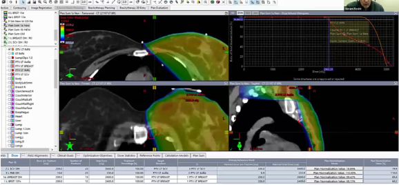 12/16/2022 - Dr. Abram Recht - Radiation Oncology - US Breast