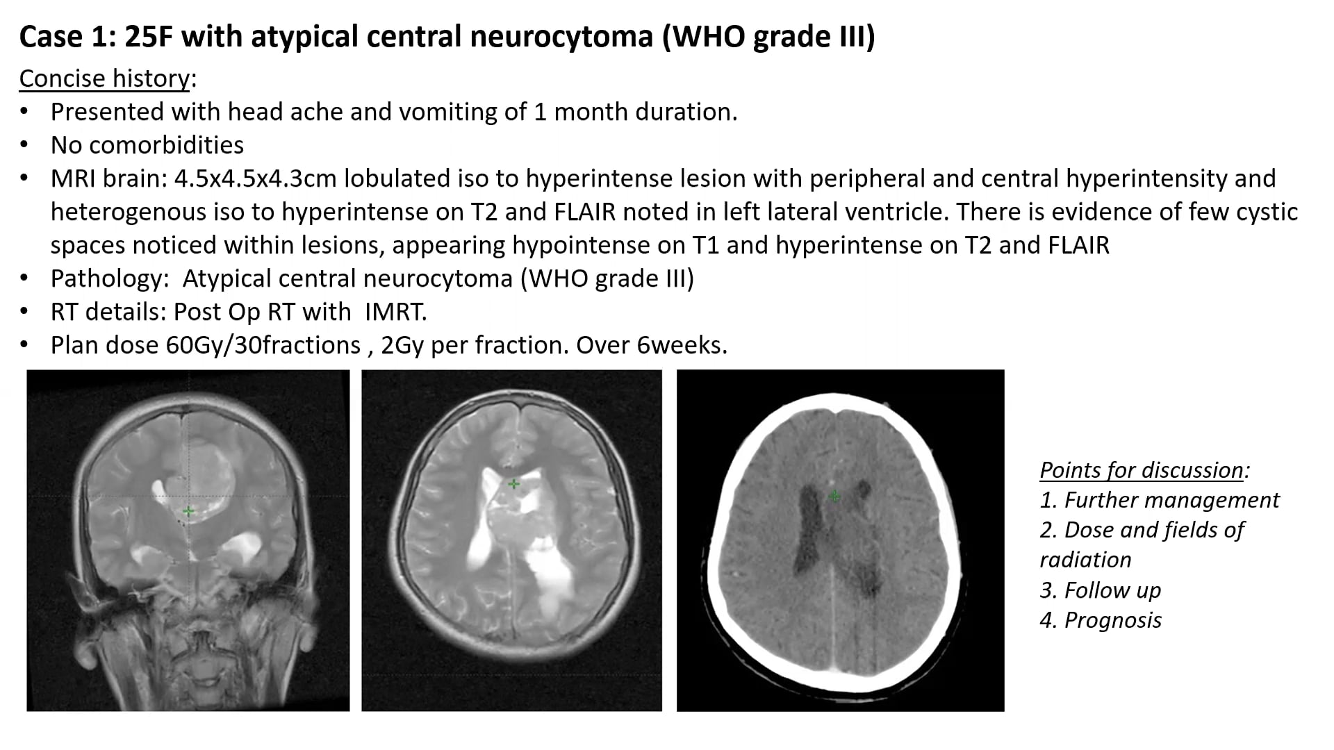 09/06/18 - Dr. Monica Malik - Radiation Oncology - CNS India