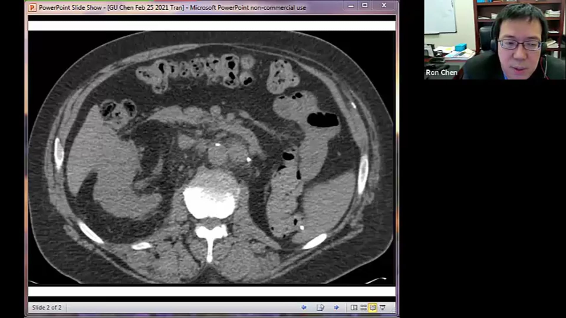02/25/21 - Dr. Ronald Chen - Radiation Oncology - GU US
