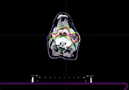 11/24/2025 - Dr. David Sher - Radiati...