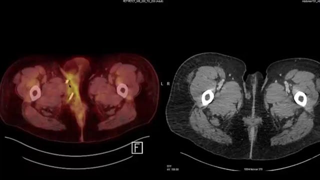 11/13/19 - Dr. Harvey Mamon - Radiati...