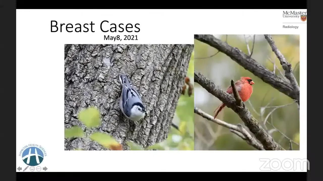 Breast Imaging - Case Based Approach Radiology Board Review - CME TV