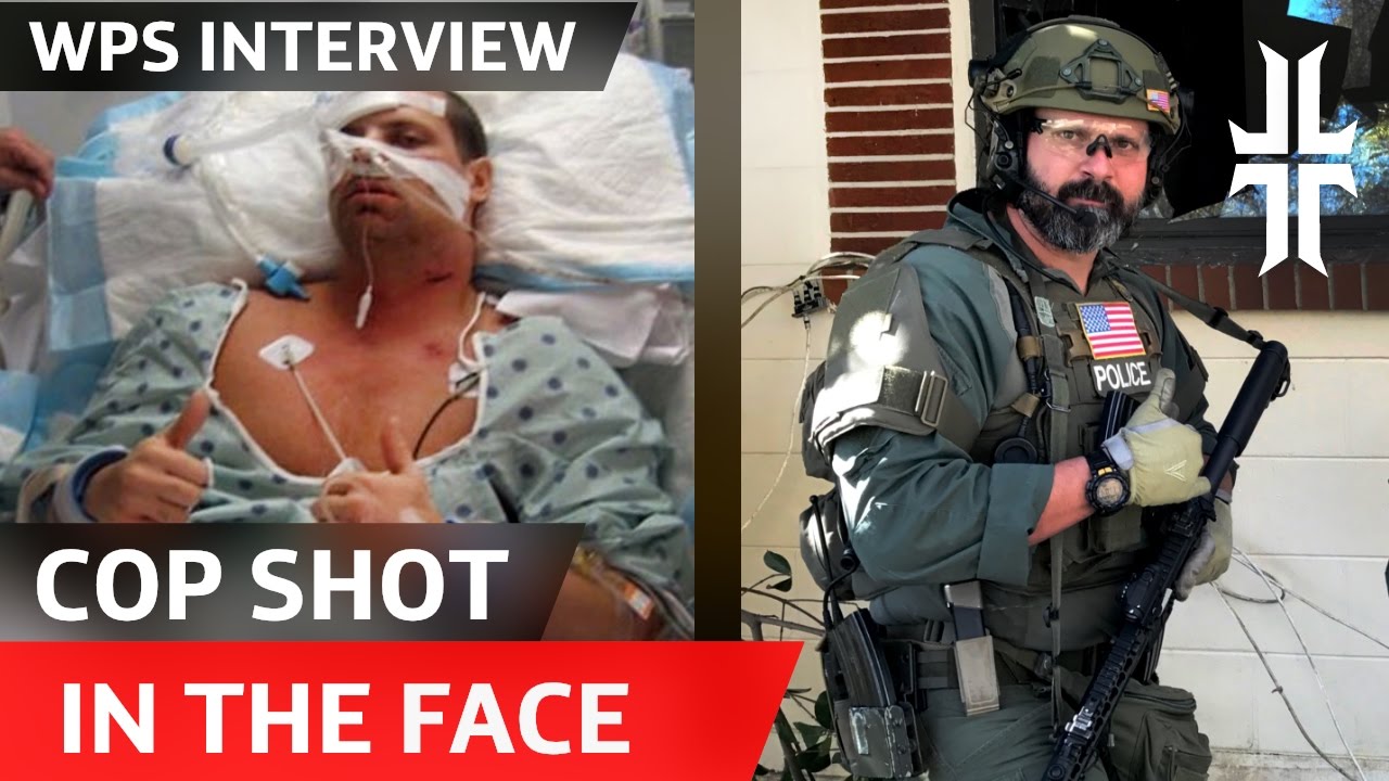 This Cop was Shot in the Face 