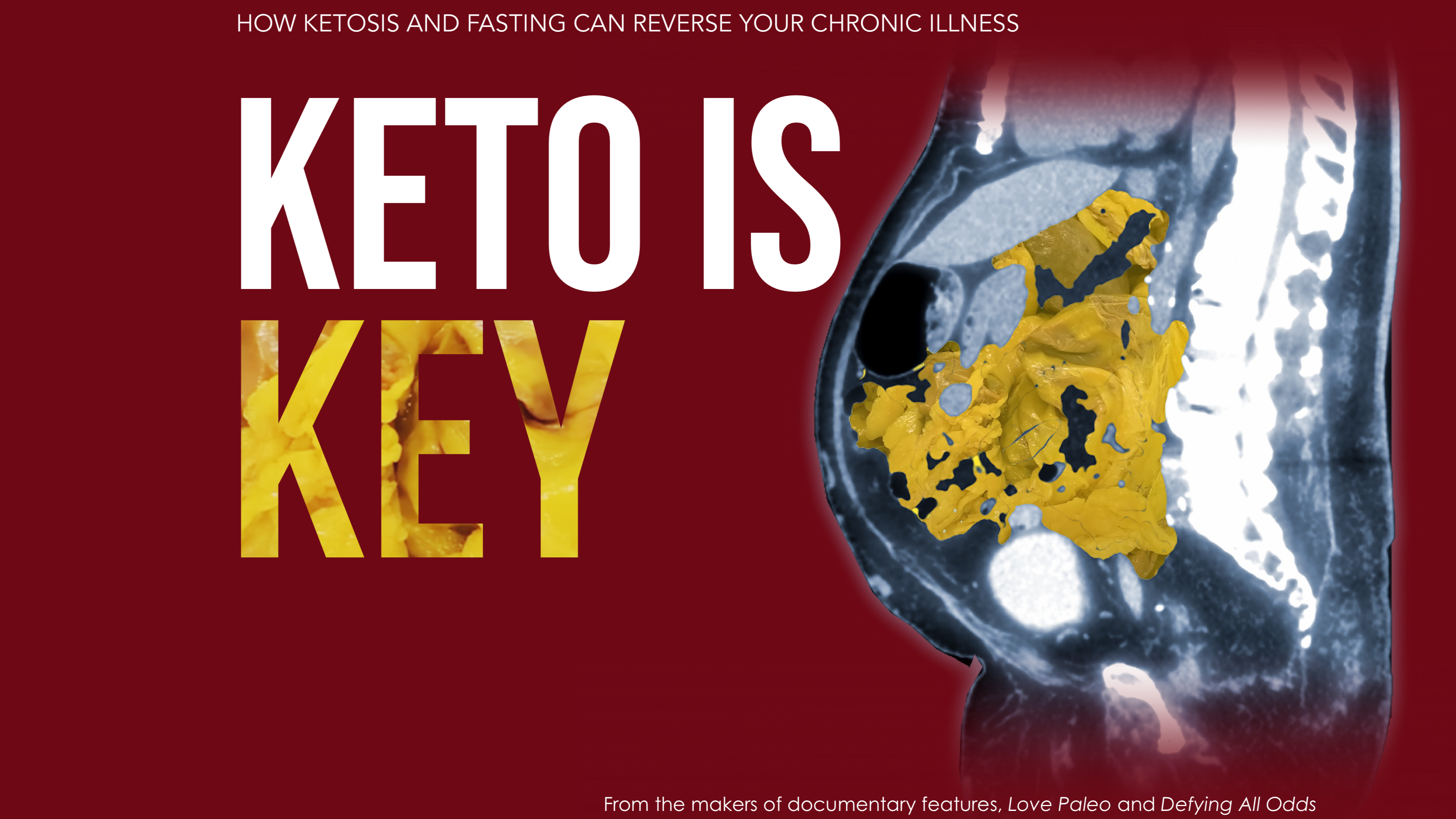 Keto Is Key––Documentary Feature