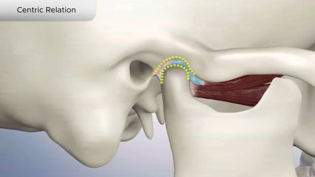 Centric Relation - Dental Patient Education Video