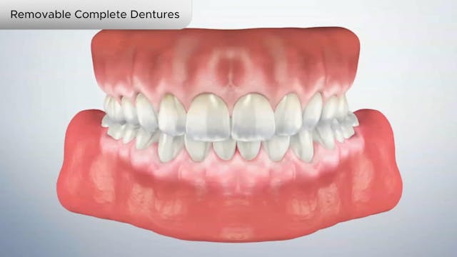 Removable Complete Dentures - Dental Patient Education Video