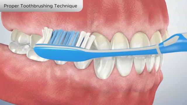 Proper Toothbrushing Technique - Dental Patient Education Video