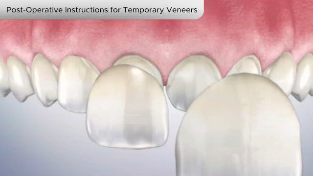 Post-Operative Instructions for Temporary Veneers-Dental Patient Education Video