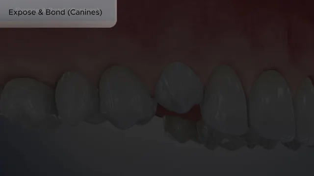 Expose & Bond (Canines)