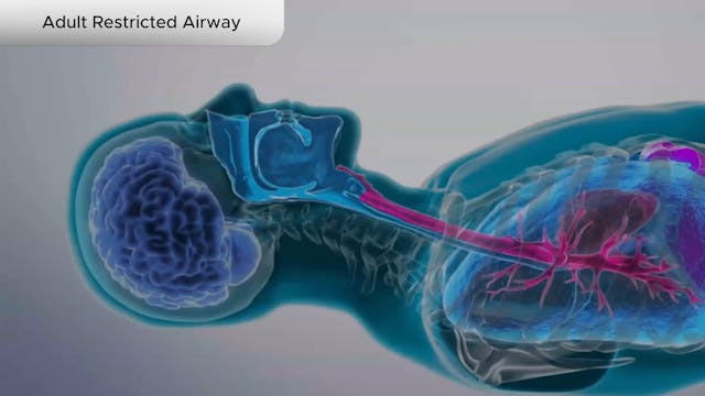 Adult Restricted Airway - Dental Patient Education Video