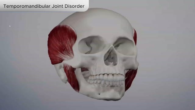 Temporomandibular Joint Disorder - Dental Patient Education Video