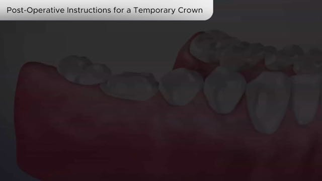 Post-Operative Instructions for Temporary Crown - Dental Patient Education Video