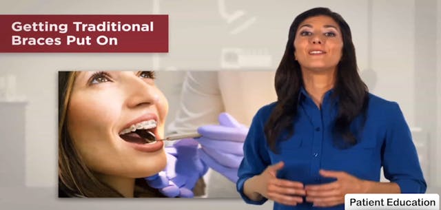 Getting Traditional Braces Put On - Dental Patient Education Video