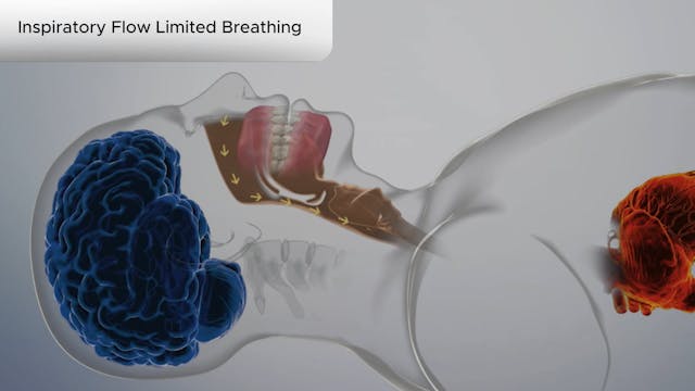 Inspiratory Flow Limited Breathing - Dental Patient Education Video