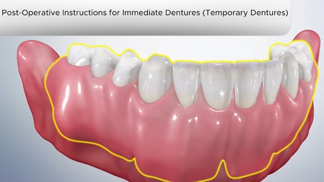 Post-Operative Instruction for Immediate Dentures-Dental Patient Education Video