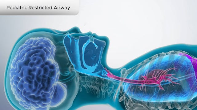 Pediatric Restricted Airway - Dental Patient Education Video