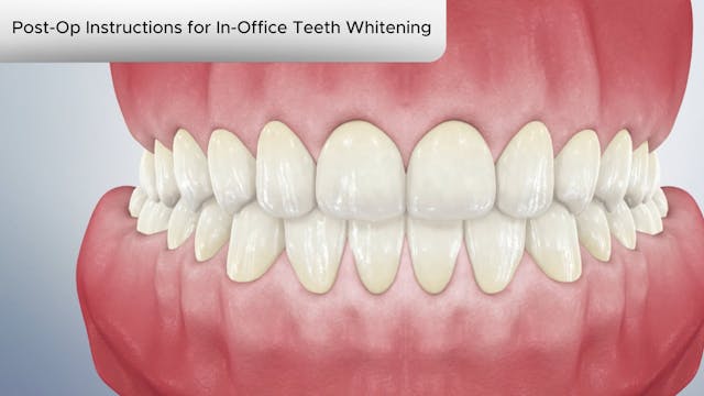 Post-Op Instruction for In-Office Teeth Whitening-Dental Patient Education Video